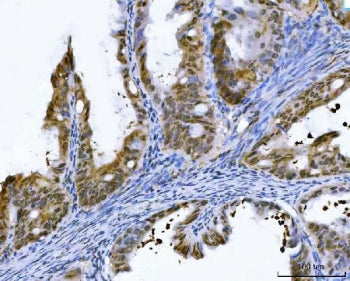 GST pi Antibody (GST3)