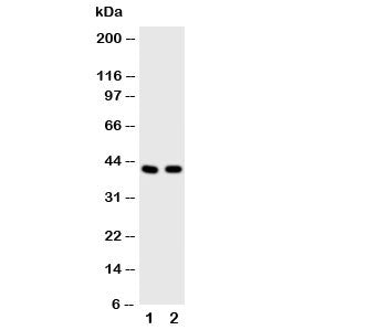 HDAC8 Antibody