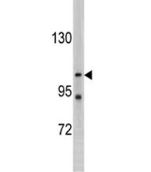 LLGL2 Antibody / HGL
