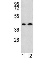 AADAT Antibody