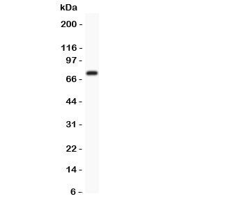 Western blot testing of Kv4.3 antibody and mouse brain lysate. Predicted/observed size ~71KD