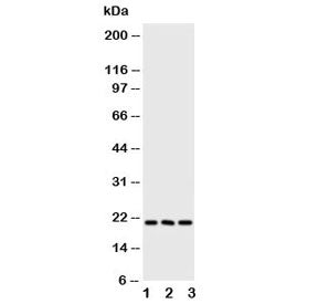 FGF21 Antibody