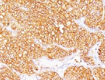 CA9 Antibody / Carbonic Anhydrase IX