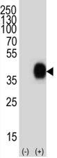 CD38 Antibody
