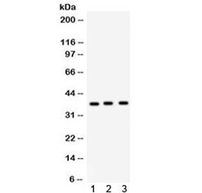 Western blot testing of 1) rat lung, 2) rat brain and 3) human PANC lysate with Surfactant protein D