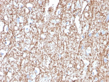 IHC staining of FFPE human brain with MBP antibody. HIER: boil tissue sections in pH 9 10mM Tris wit