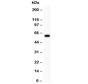 ATM Antibody