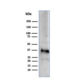 Western blot testing of human testis tissue lysate using Apolipoprotein J antibody (clone CLU/4729).