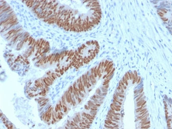 CDX2 Antibody
