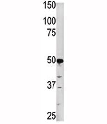 PGK2 Antibody