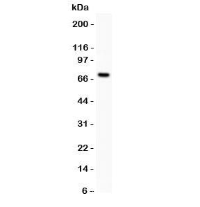 Western blot testing of Estrogen Receptor antibody and MCF-7 lysate (human breast tumor cell line). 
