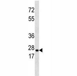 Endoplasmic Reticulum Amyloid Binding Protein Antibody (ERAB)