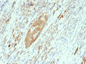 GAD65 Antibody