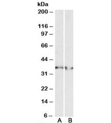 LDHB Antibody
