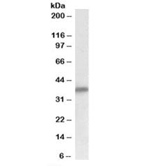 Delta-Sarcoglycan Antibody