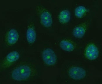 Immunofluorescent staining of FFPE human PC-3 cells with TRANK1 antibody (green) and DAPI nuclear st