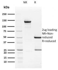 SDS-PAGE analysis of purified, BSA-free HPV16 E2 antibody (TVG 261) as confirmation of integrity and