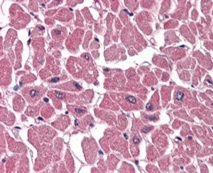 ABTB1 Antibody