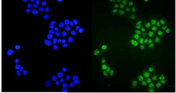 PLZF Antibody / ZBTB16
