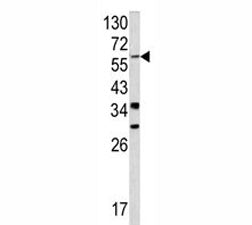 YAP1 Antibody