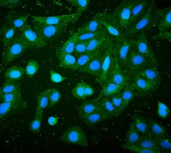 RP2 Antibody / XRP2