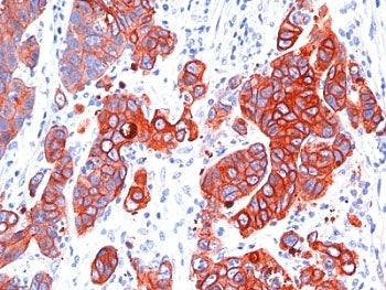 Multi Cytokeratin Antibody