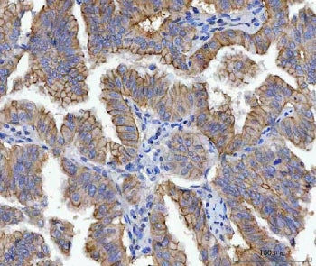 JUP Antibody / Junction Plakoglobin / Gamma Catenin