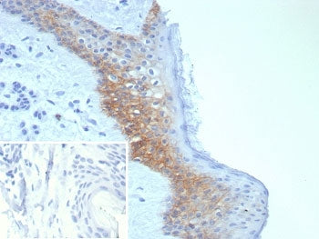 Desmoglein 3 Antibody / DSG3