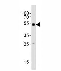 Western blot testing of Smad1 antibody at 1:1000 dilution + mouse skeletal muscle lysate; Predicted 