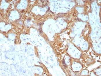 IHC staining of FFPE human placental tissue with Galectin-13 antibody (clone PP13/8897). Inset: PBS 