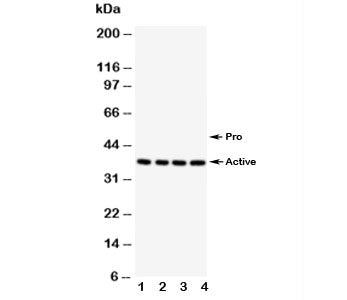 Western blot testing of Caspase-12 antibody; Lane 1: PANC; 2: SMMC-7721; 3: A549; 4: HeLa. Predicted