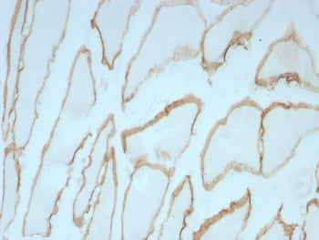 IHC staining of FFPE human skeletal muscle tissue with Dystrophin antibody (clone DMD/8773R). HIER: 