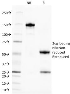 SDS-PAGE analysis of purified, BSA-free TAG-72 antibody (CA72/145) as confirmation of integrity and 