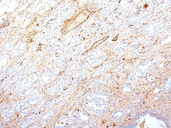 FN1 Antibody / Fibronectin