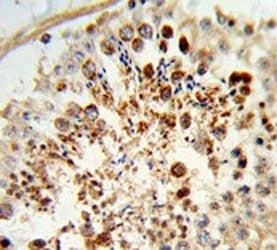 COX6A1 Antibody