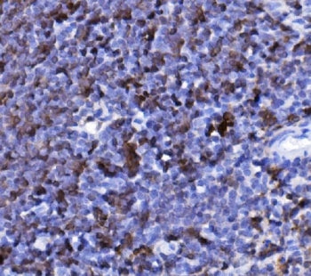 Cd20 Antibody
