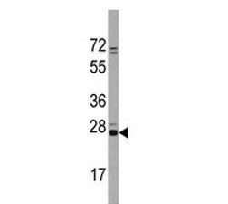 CD9 Antibody