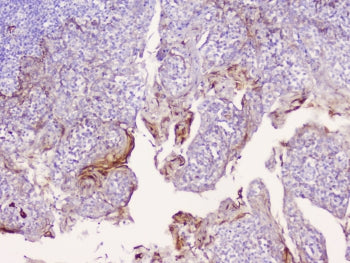 CD1b Antibody