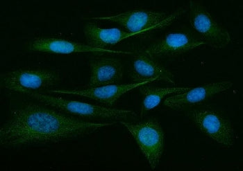 Immunofluorescent staining of FFPE human U-2 OS cells with ADAM9 antibody (green) and DAPI nuclear s