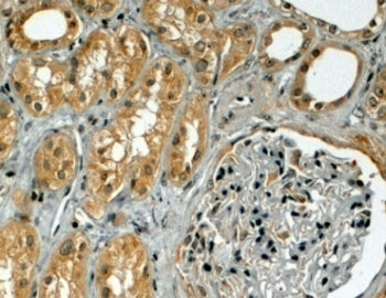 IHC testing of FFPE human kidney with TRIM5 antibody at 4ug/ml. HIER: steamed with pH6 citrate buffe