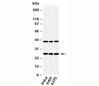 CLEC4E Antibody