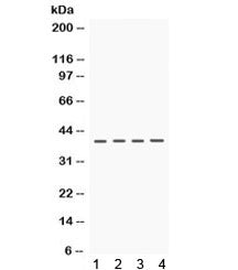 Western blot testing of 1) rat brain, 2) rat kidney, 3) mouse kidney and 4) human HeLa lysate with C