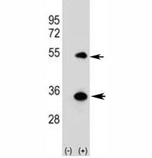 ATG5 Antibody