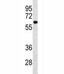 PIGS Antibody