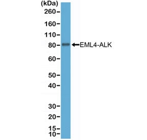 ALK Antibody / Anaplastic lymphoma kinase
