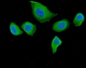 DAB2 Antibody / Disabled homolog 2
