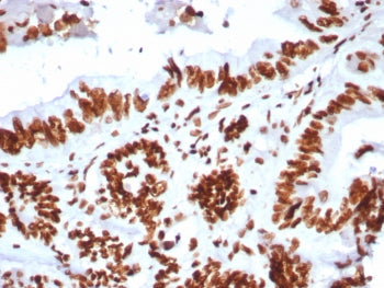 IHC staining of FFPE human colon tissue with SMARCA4 antibody (clone BRG1/8805R). HIER: boil tissue 