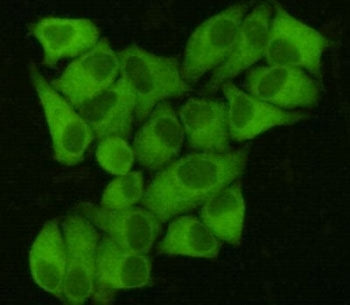 ICC/IF staining of HeLa cells, fixed with 4% Paraformaldehyde, using FASN antibody at 1:200.