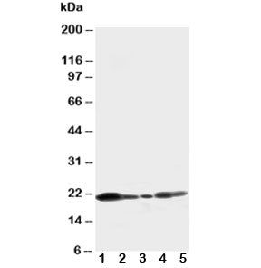 Western blot testing of Caveolin-1 antibody and Lane 1: U87; 2: HeLa; 3: MCF-7; 4: A549; 5: HT1080 c
