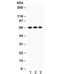 Western blot testing of 1) rat brain, 2) rat testis, 3) human HeLa lysate with Cryptochrome I antibo